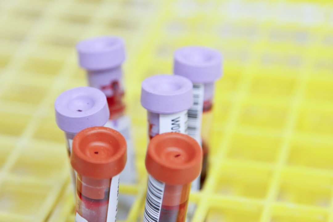 Reageerbuisjes met bloedmonsters voor een drugstest – thc aantoonbaar in het lichaam